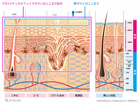 difference_p03.jpg